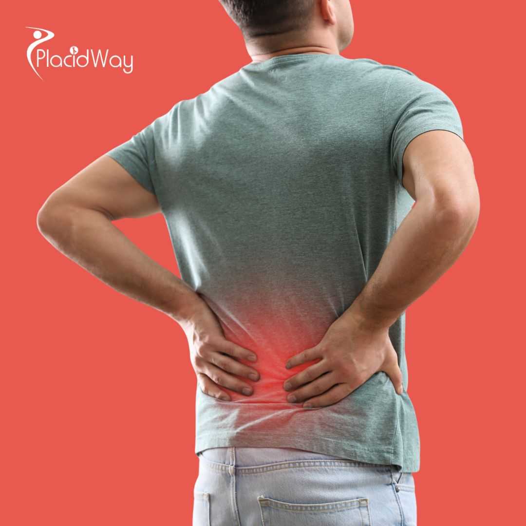 Stem Cell Therapy for Degenerative Disc in Cali, Colombia 