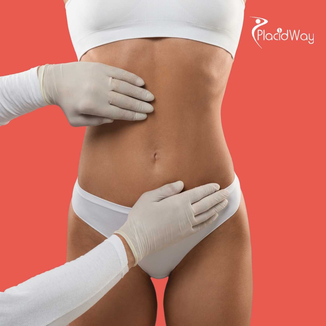 Tummy Tuck in South Korea: Sculpt Your Ideal Shape