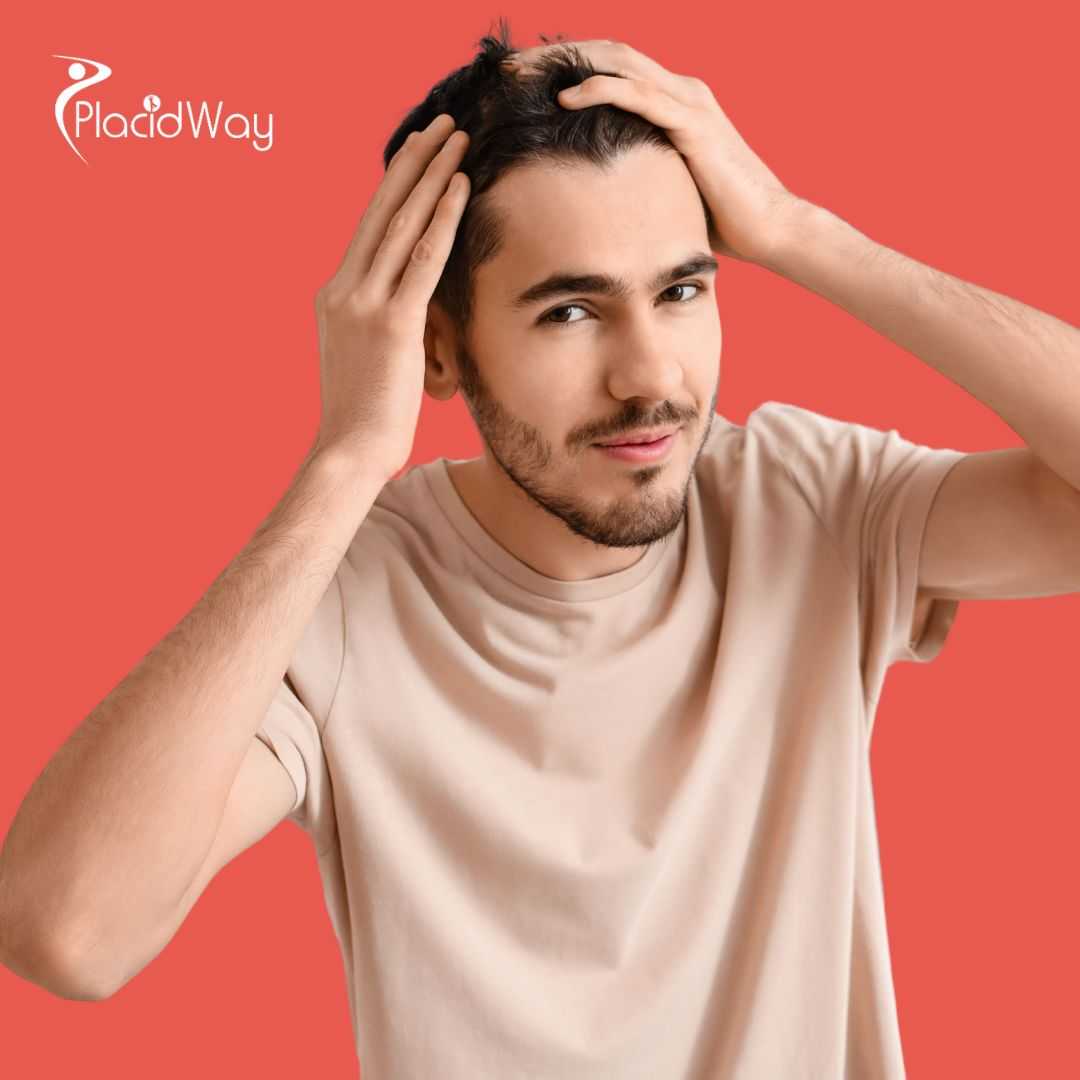 Stem Cell Therapy for Hair Loss in Tijuana, Mexico