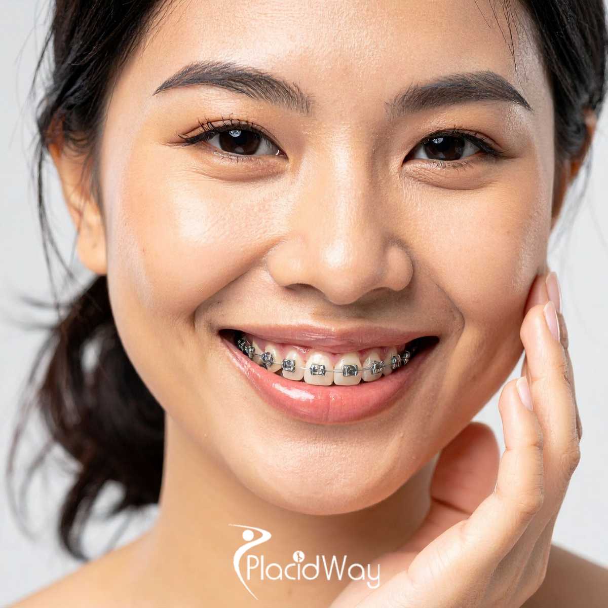 Dental Work in India