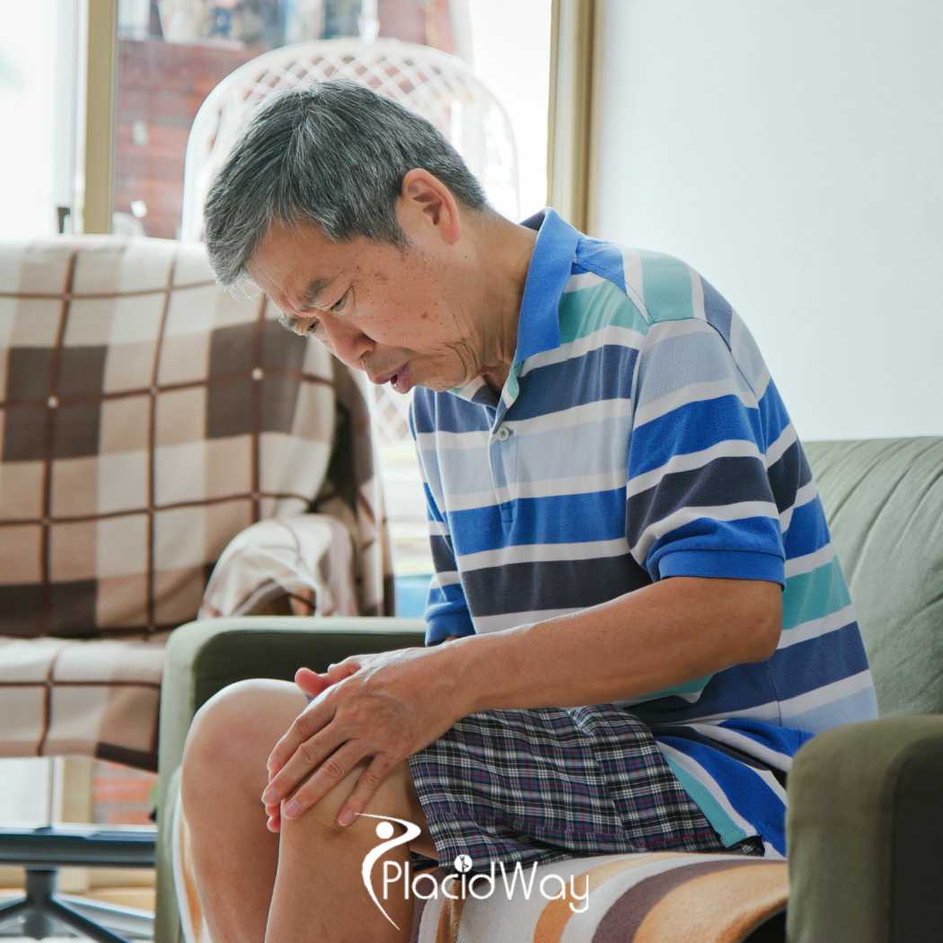 Stem Cell Therapy for Knee Osteoarthritis in Japan