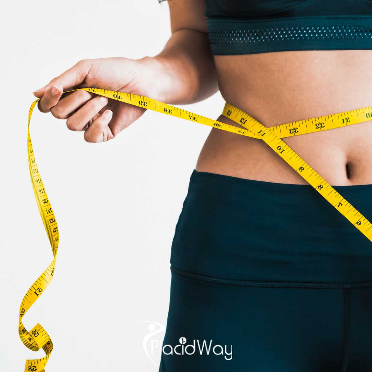 Revision Bariatric Surgery in Mexico 