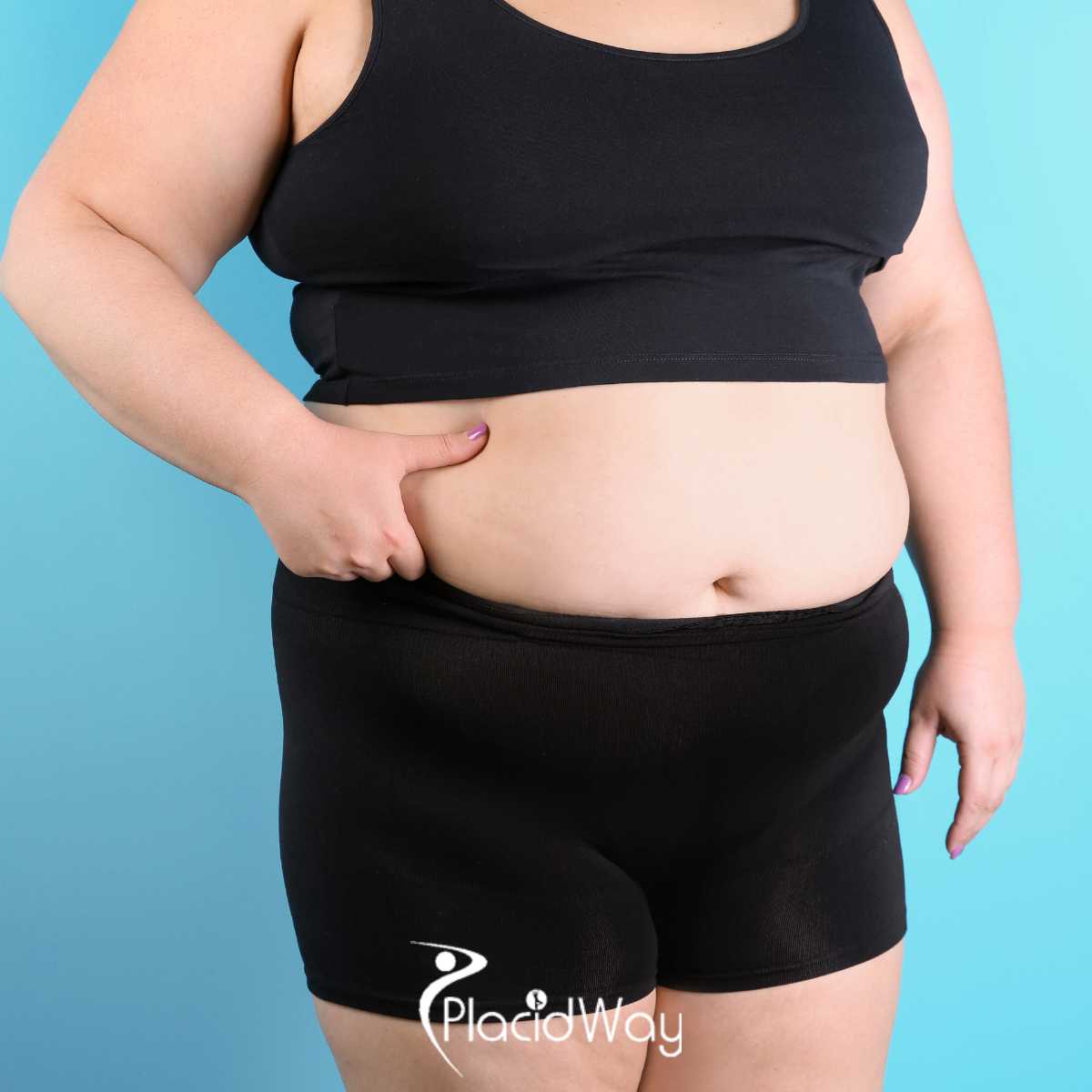 Gastric Balloon in Mexico