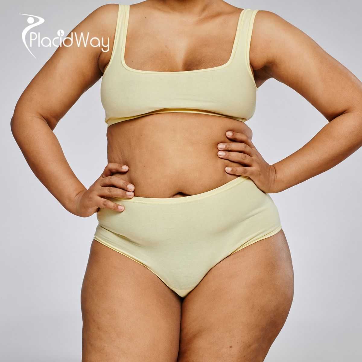 Duodenal Switch Surgery in Tijuana Mexico