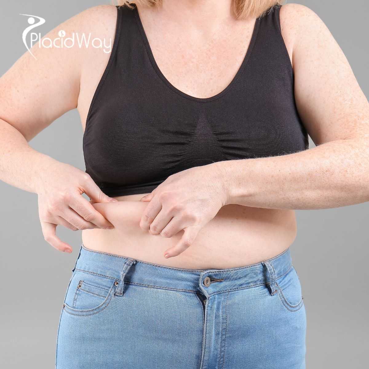 Gastric Bypass Surgery in Piedras Negras, Mexico