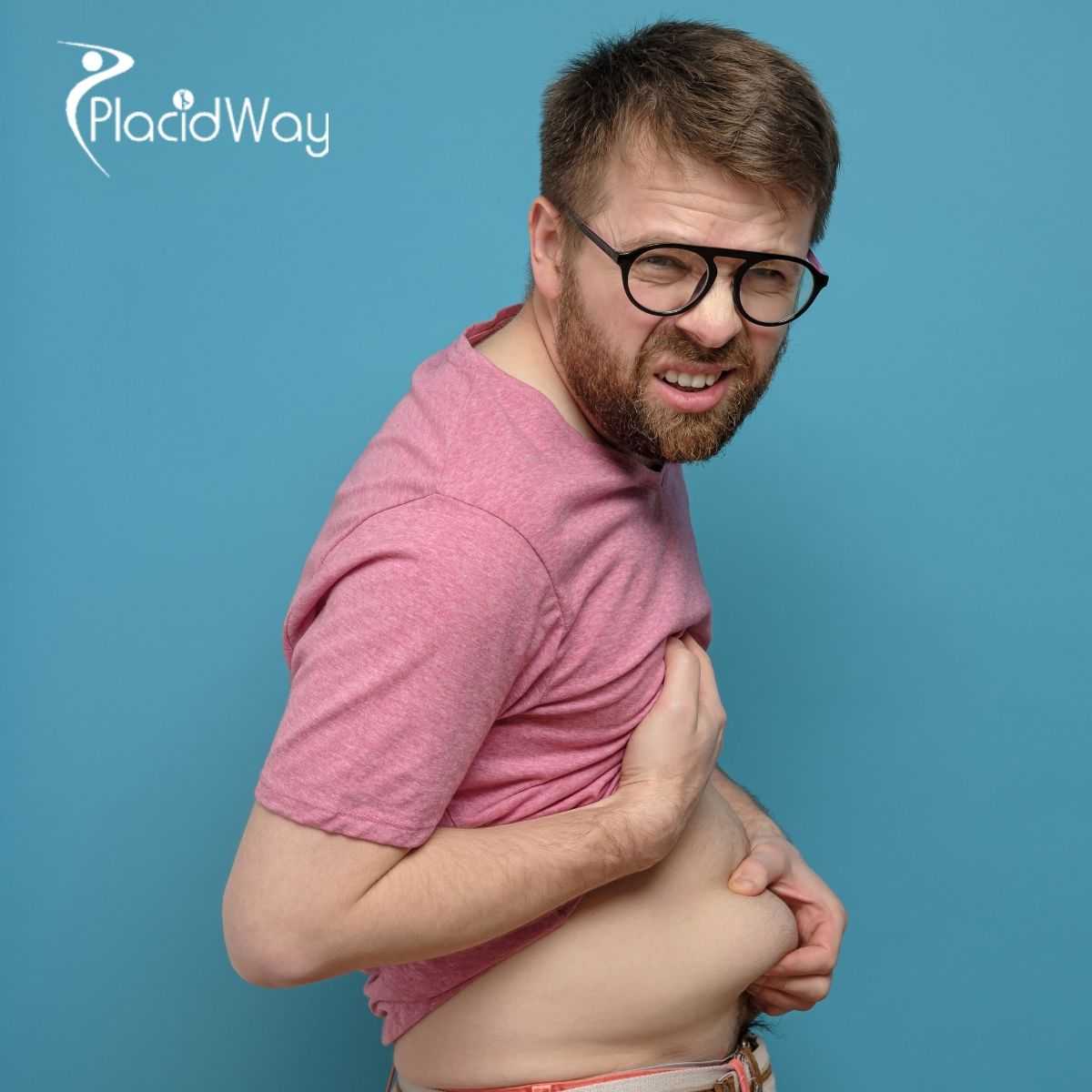 Gastric Sleeve Surgery in Merida, Mexico