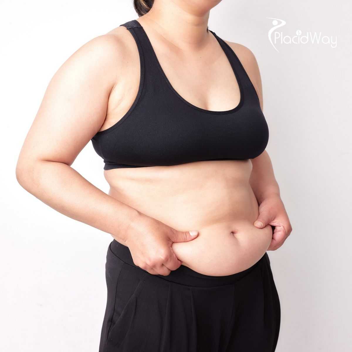 Tummy Tuck in Costa Rica