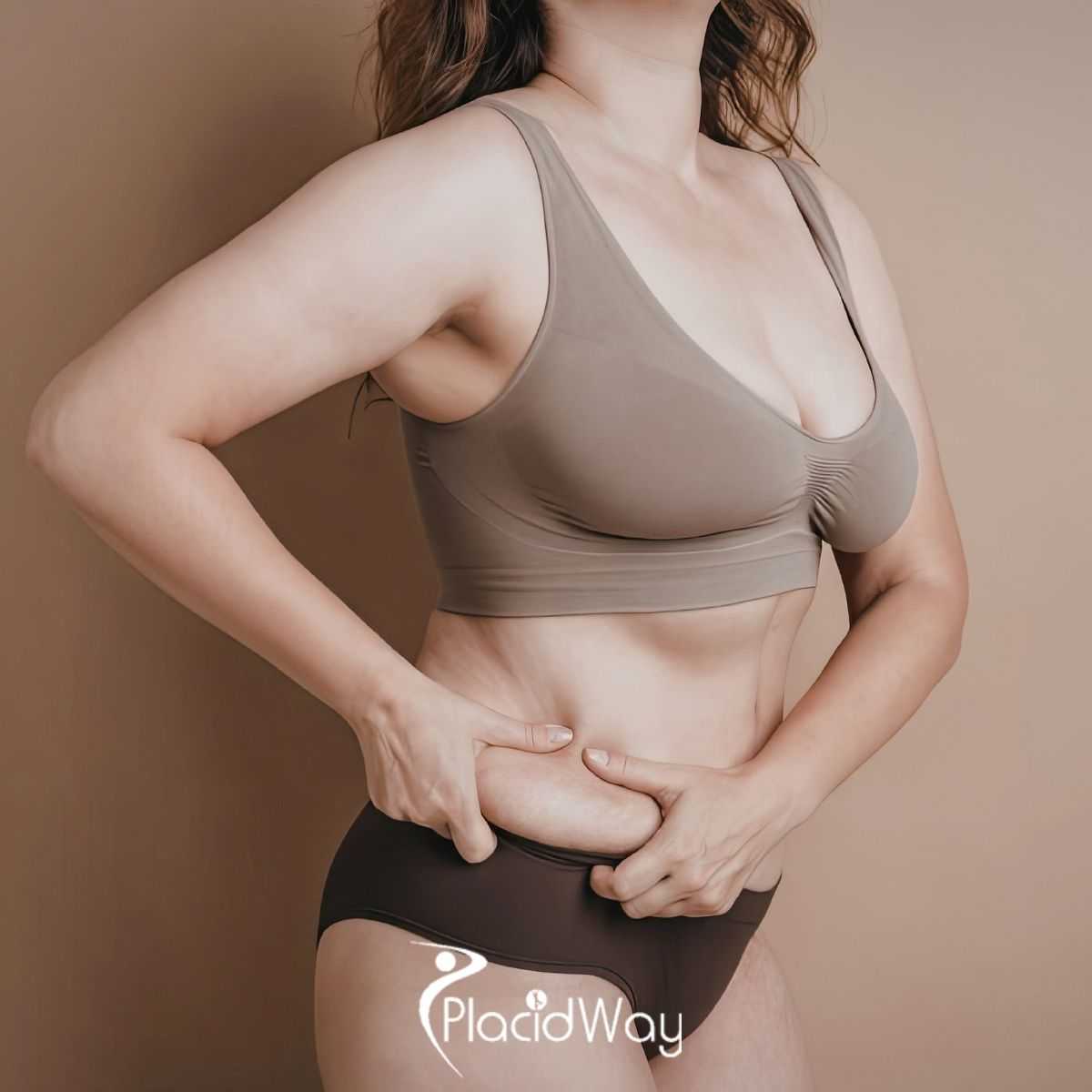Tummy Tuck in Bogota, Colombia