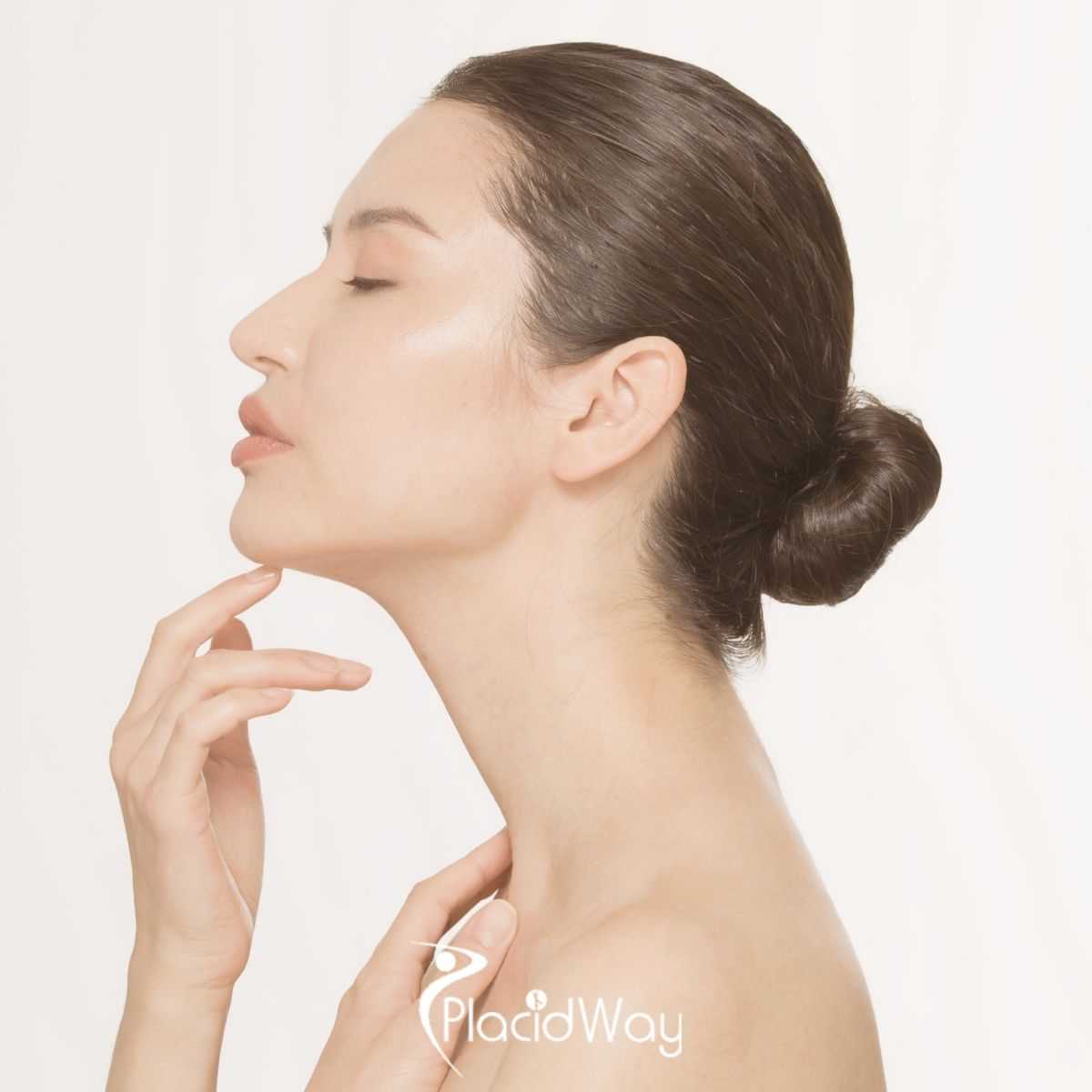 Neck Lift in Mexicali, Mexico