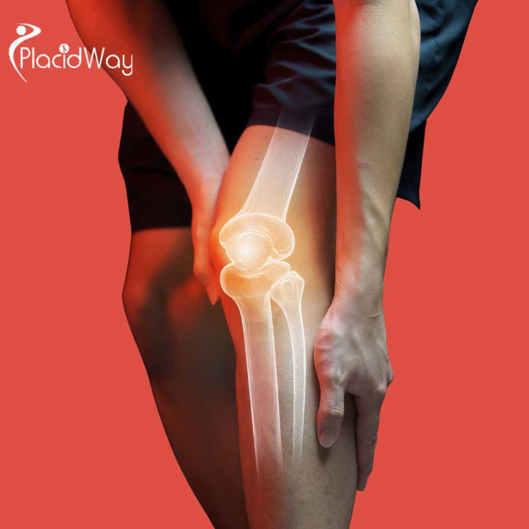Dubai-Becomes-the-Global-Hub-for-Non-Surgical-Knee-Replacement-via-Advanced-MSC-Stem-Cell-Therapy