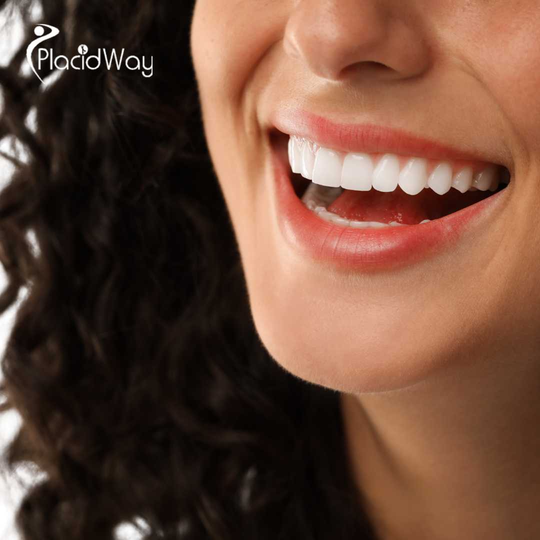 Veneers-in-Egypt-A-2026-Guide-for-International-Patients-Seeking-the-Perfect-Hollywood-Smile-on-a-Budget