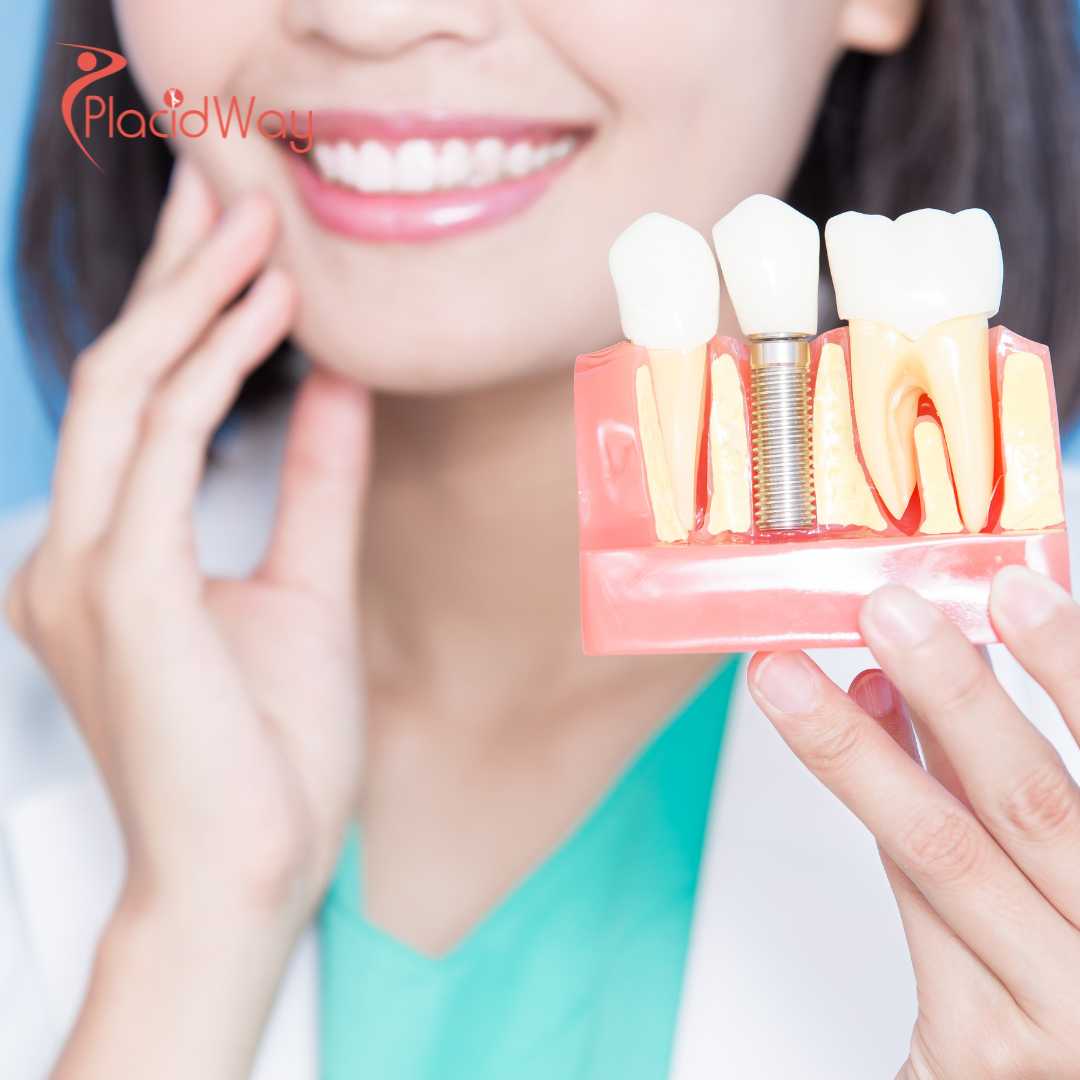 Advanced-Titanium-vs-Zirconia-Egypts-Dental-Clinics-Lead-2026-Innovations-in-Permanent-Tooth-Replacement