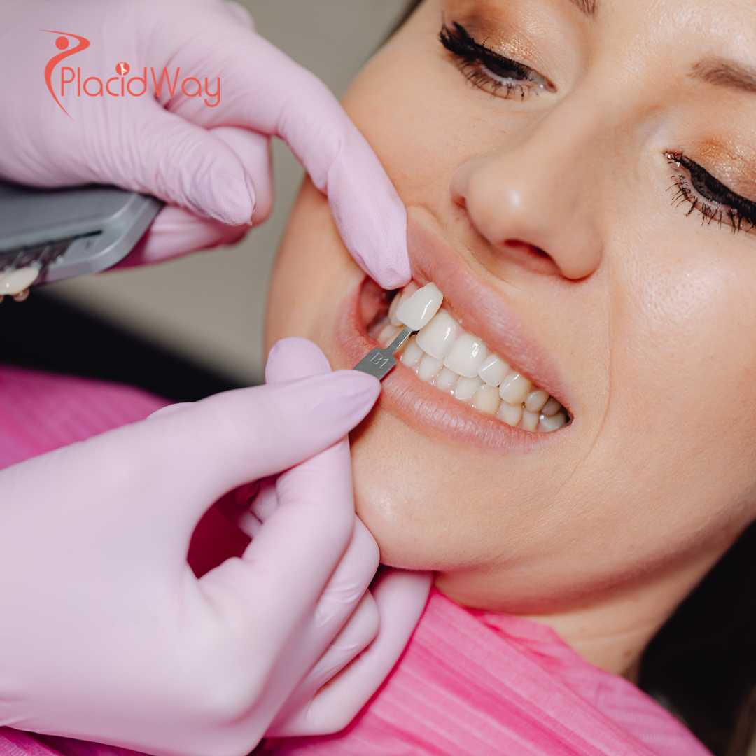 The-Antalya-Veneer-Takeover-How-Turkeys-Mediterranean-Coast-Redefined-Cosmetic-Dentistry-for-Gen-Z
