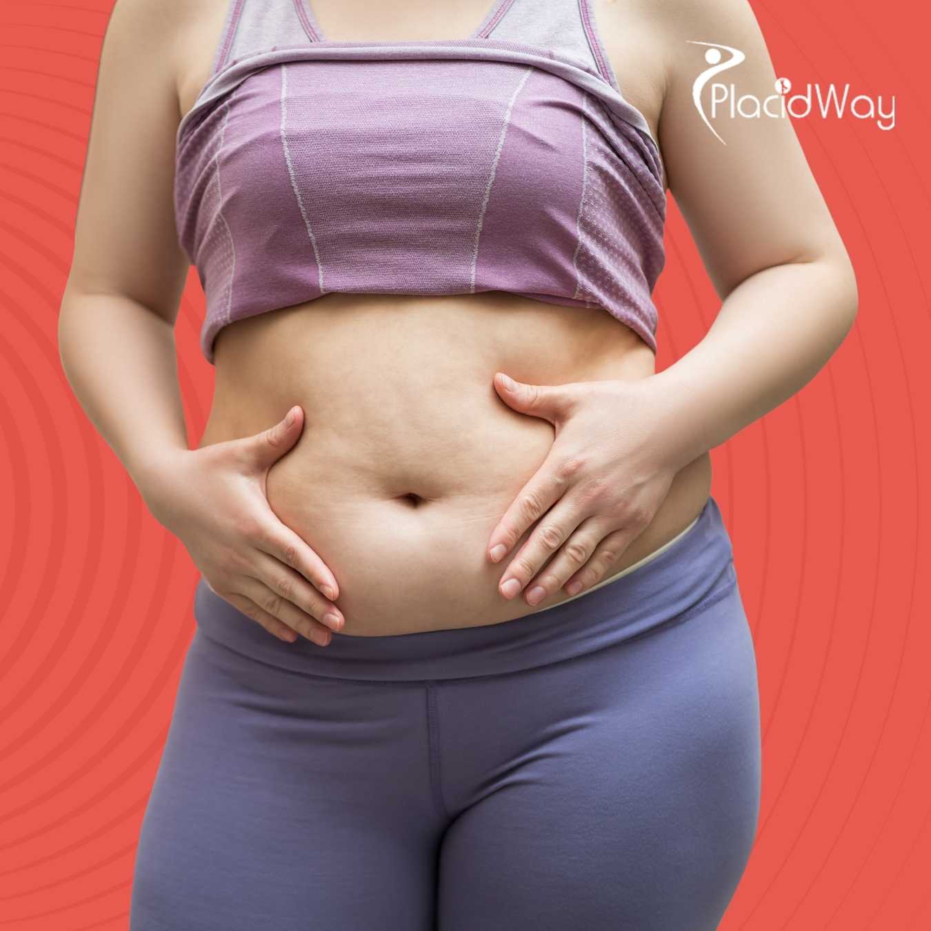 Restoring-Confidence-Overseas-Vietnams-Surge-in-Tummy-Tuck-Procedures-for-New-Zealand-and-Aussie-Travelers