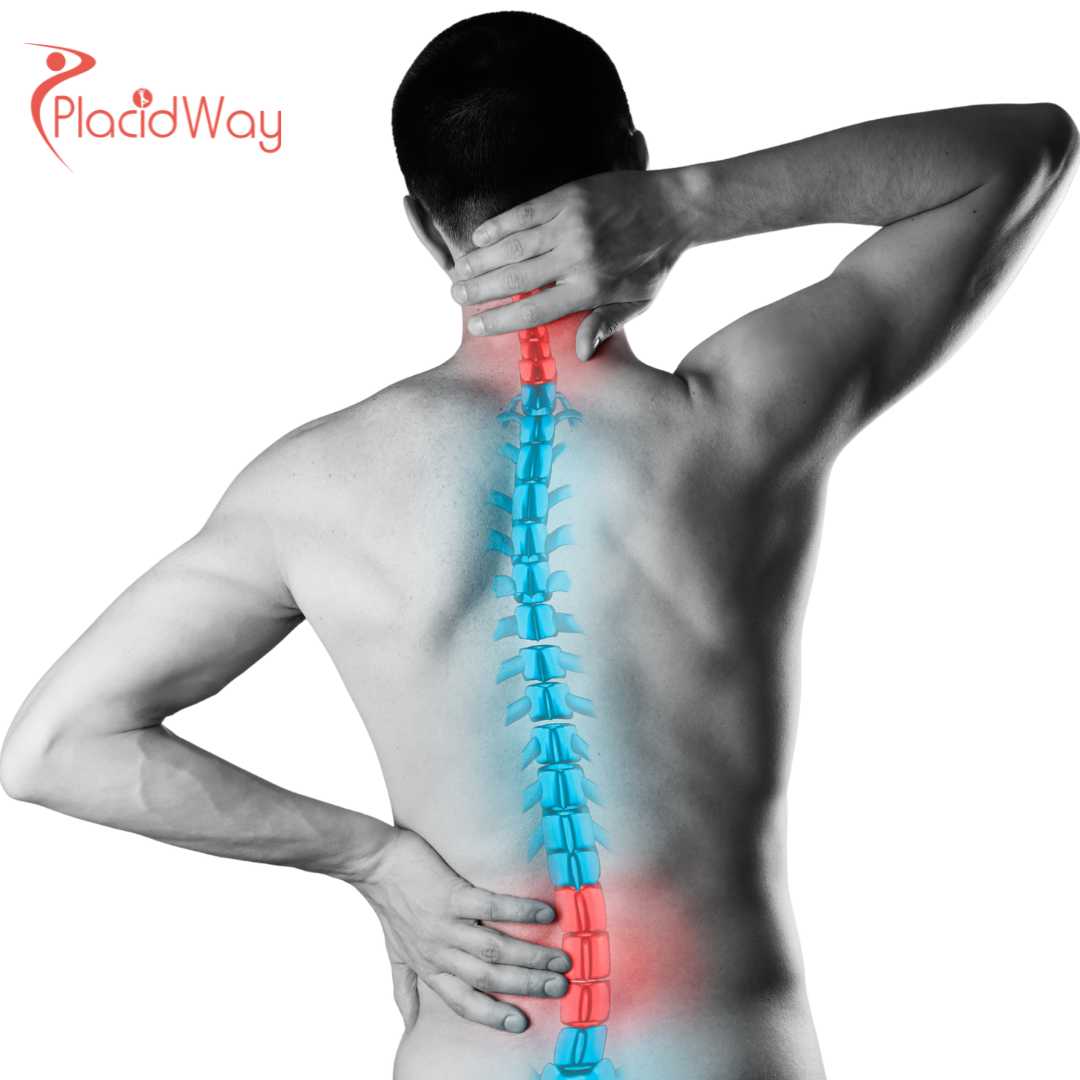 Beyond-Aesthetics-Why-Global-Athletes-are-Flying-to-Turkey-for-Career-Saving-Spine-Surgeries