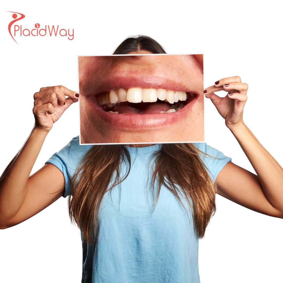 Vietnams-All-on-4-Revolution-Why-Thousands-of-Australians-are-Choosing-Ho-Chi-Minh-City-for-Full-Mouth-Restorations-in-2026