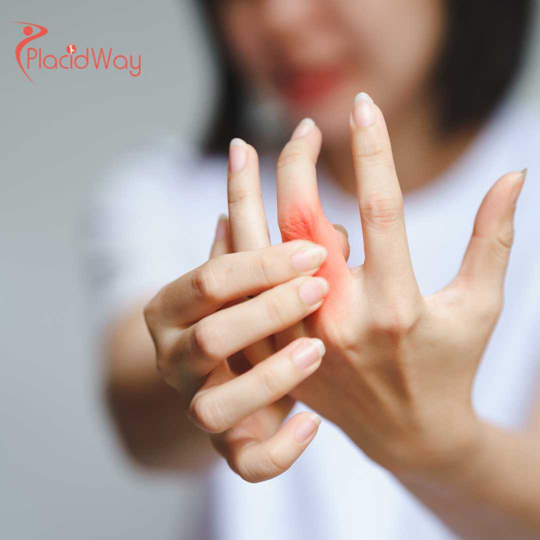 Rheumatoid-Arthritis-Relief-Why-Australian-Demand-for-Thailands-MSC-Therapy-Has-Tripled-in-2026
