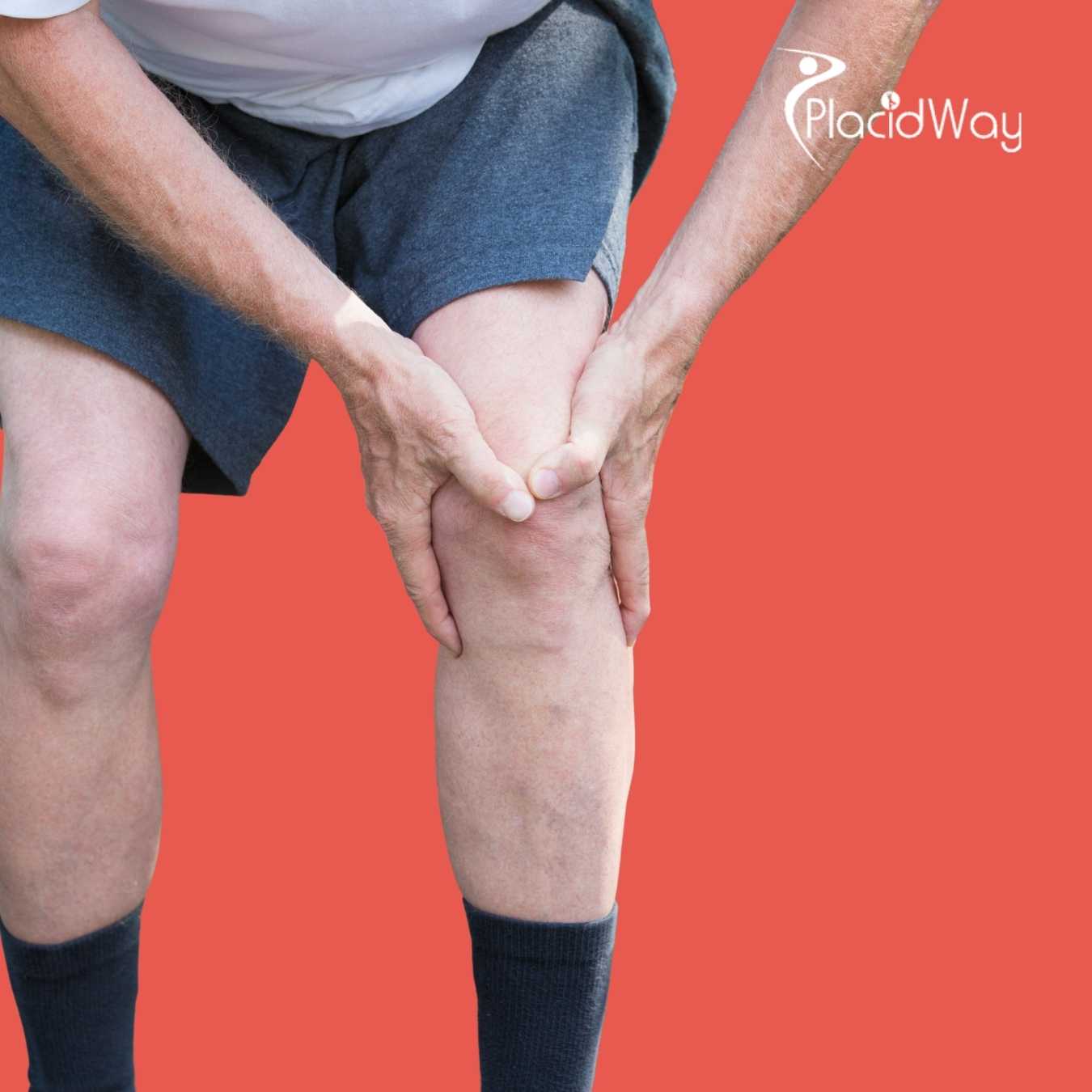 Istanbul-Becomes-the-Go-To-Destination-for-Fast-Track-ACL-Reconstruction-for-CIS-Athletes