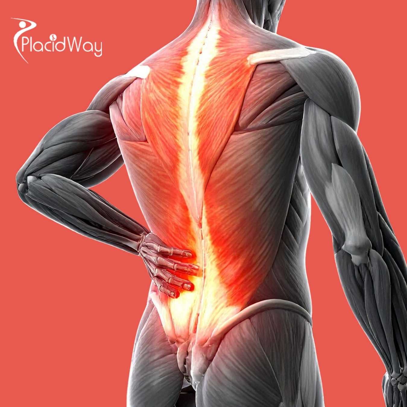 European-Demand-for-Cervical-Disc-Replacement-Surges-in-Turkey-Amid-Domestic-Pricing-Crisis