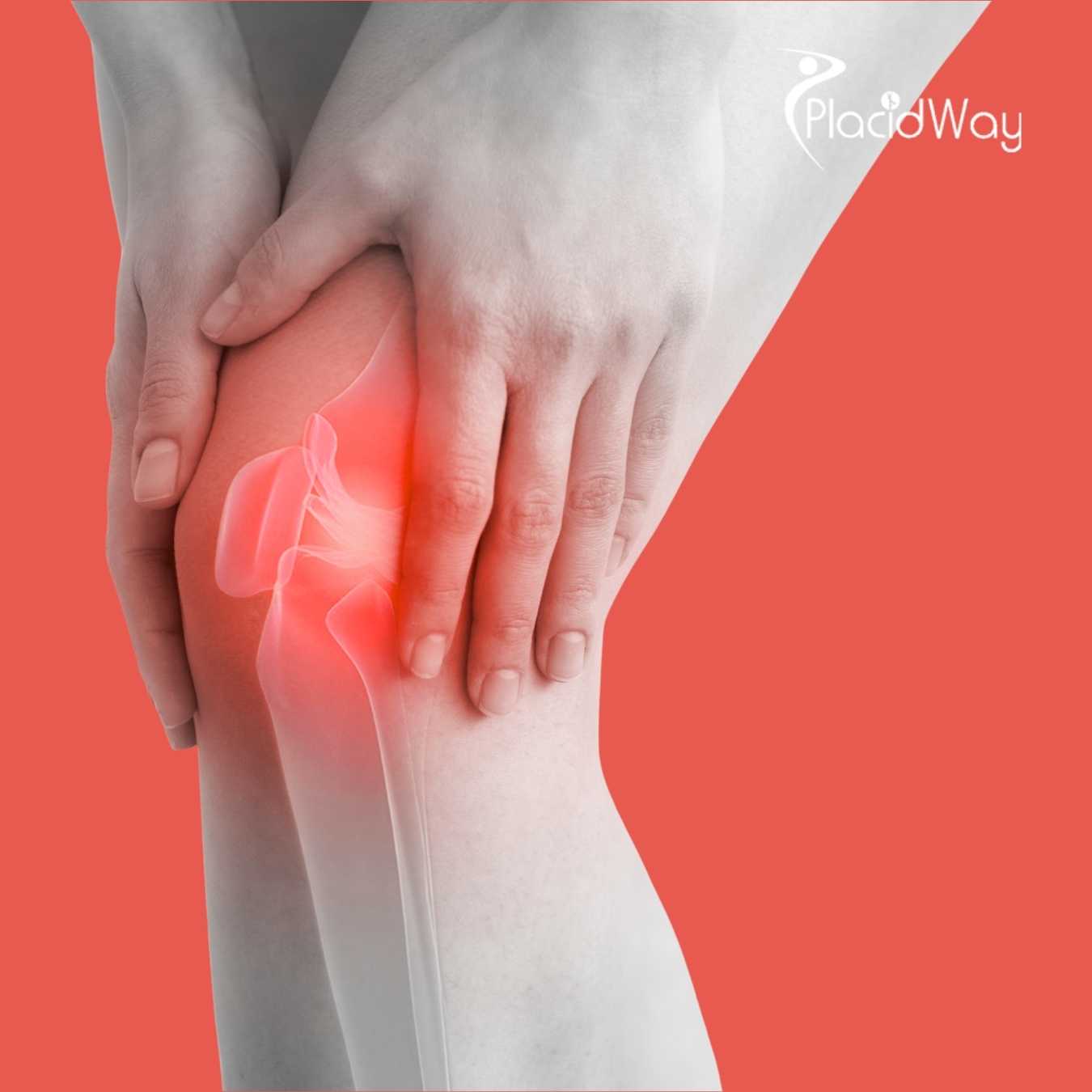 Thailand-Validated-as-Global-Center-of-Excellence-for-Stem-Cell-Orthopedics-in-2026-Market-Shift
