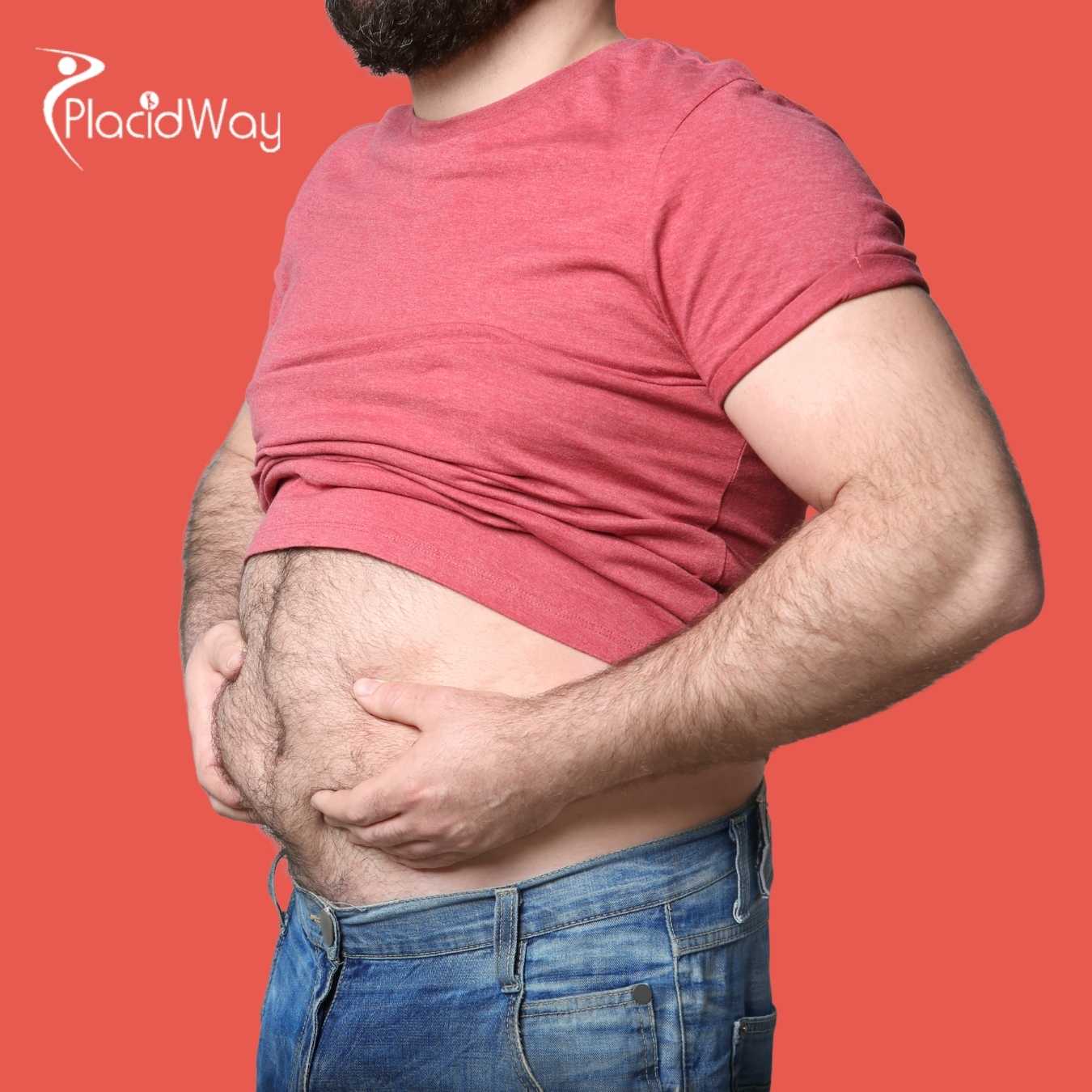 Canadians-Bypass-Healthcare-Delays-for-Expert-Tummy-Tuck-Surgeries-in-Cancun-Mexico