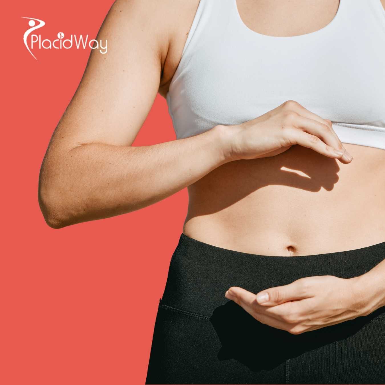 US-Bariatric-Patients-Complete-Their-Journeys-with-Affordable-Tummy-Tucks-in-Tijuana-Mexico