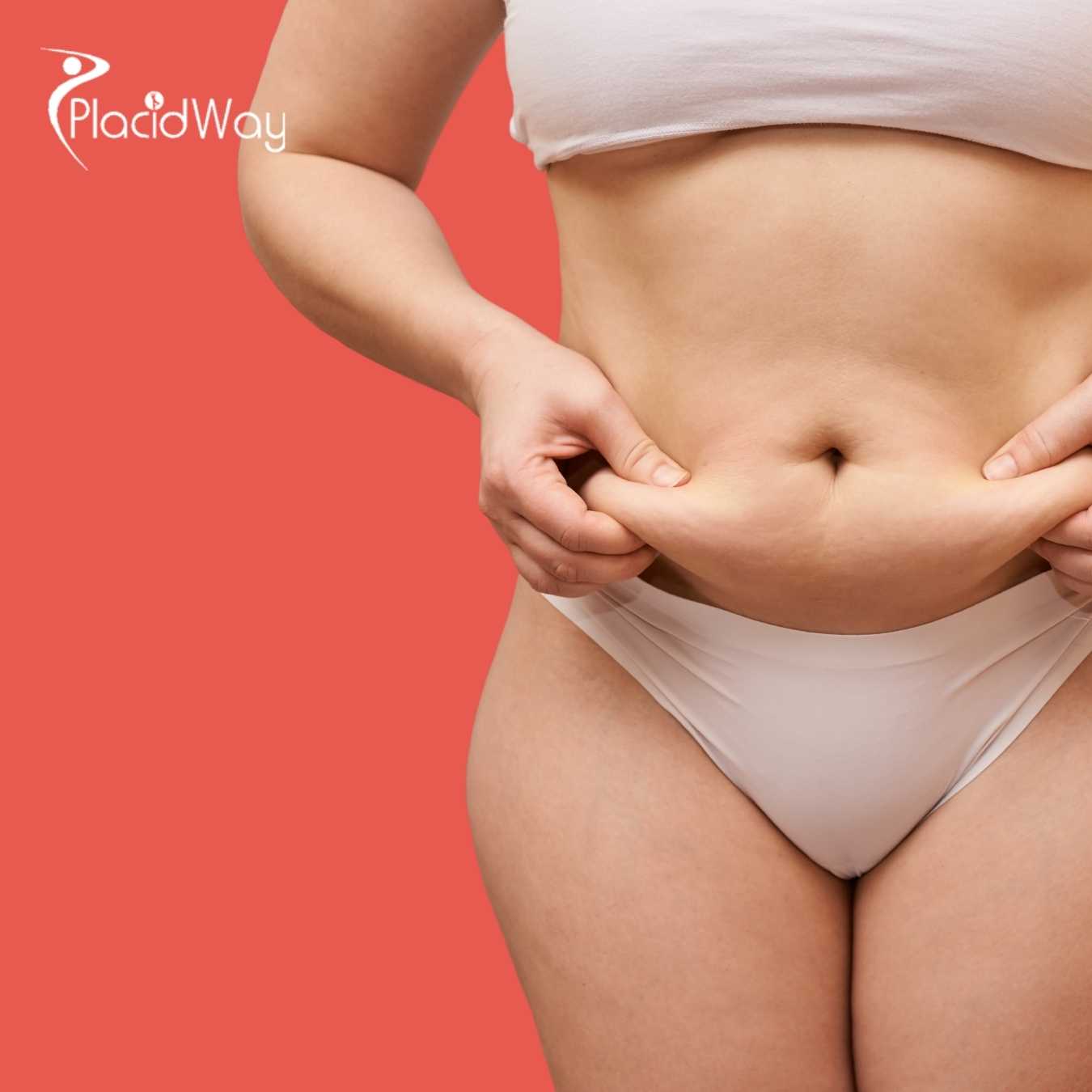 Post-Pregnancy-Tourism-Mexico-City-Mexico-Sees-Influx-of-US-Patients-for-Complex-Body-Contouring