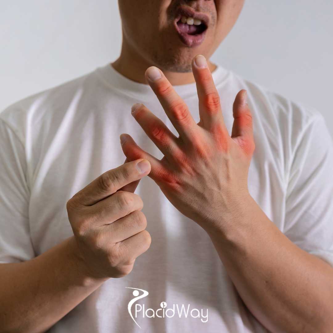 Pain-Free-Dexterity-Indonesians-Avoid-Surgery-with-Tokyos-Stem-Cell-Injections-for-Hand-and-Wrist-Function-Recovery