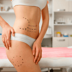 Mommy Makeover Package in Merida, Mexico by Dr. Ernesto Acosta Abeyta