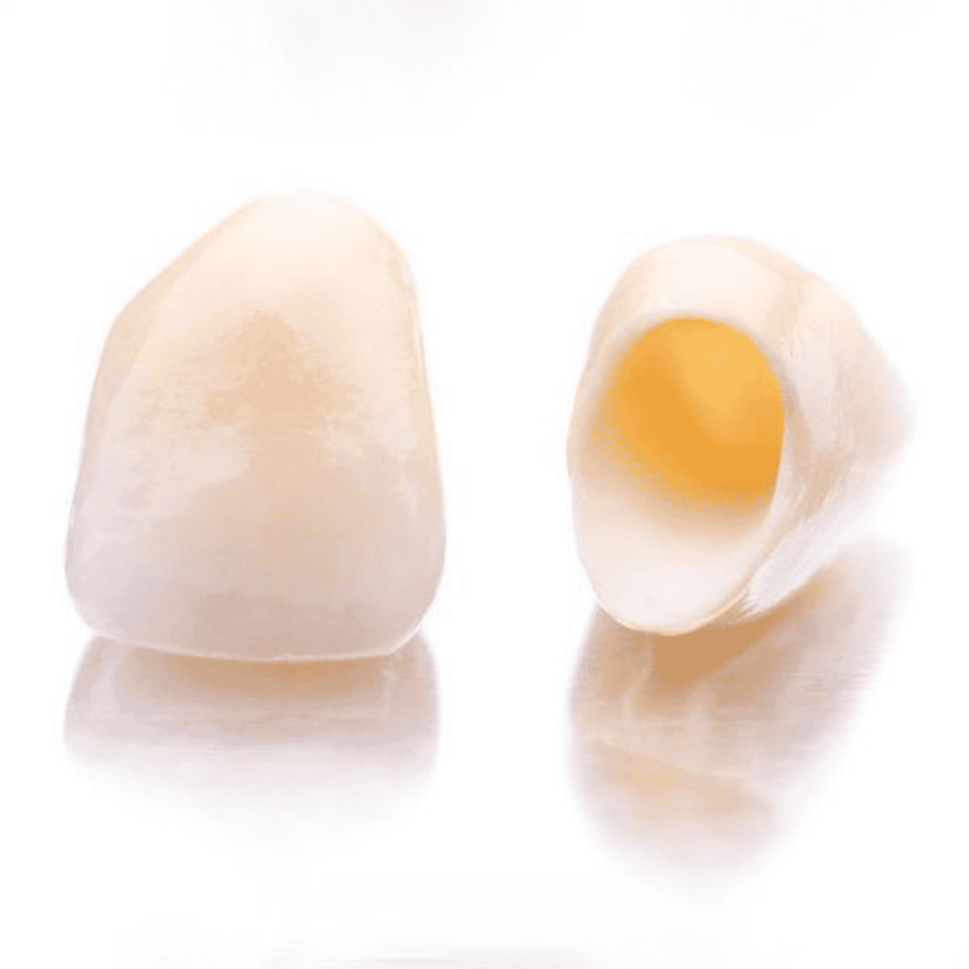 Dental Crowns in Los Algodones, Mexico