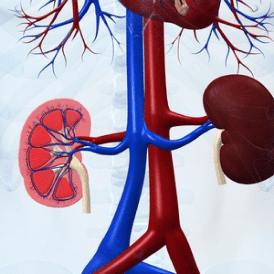 Stem Cell Therapy for Kidney Disease in Mexico