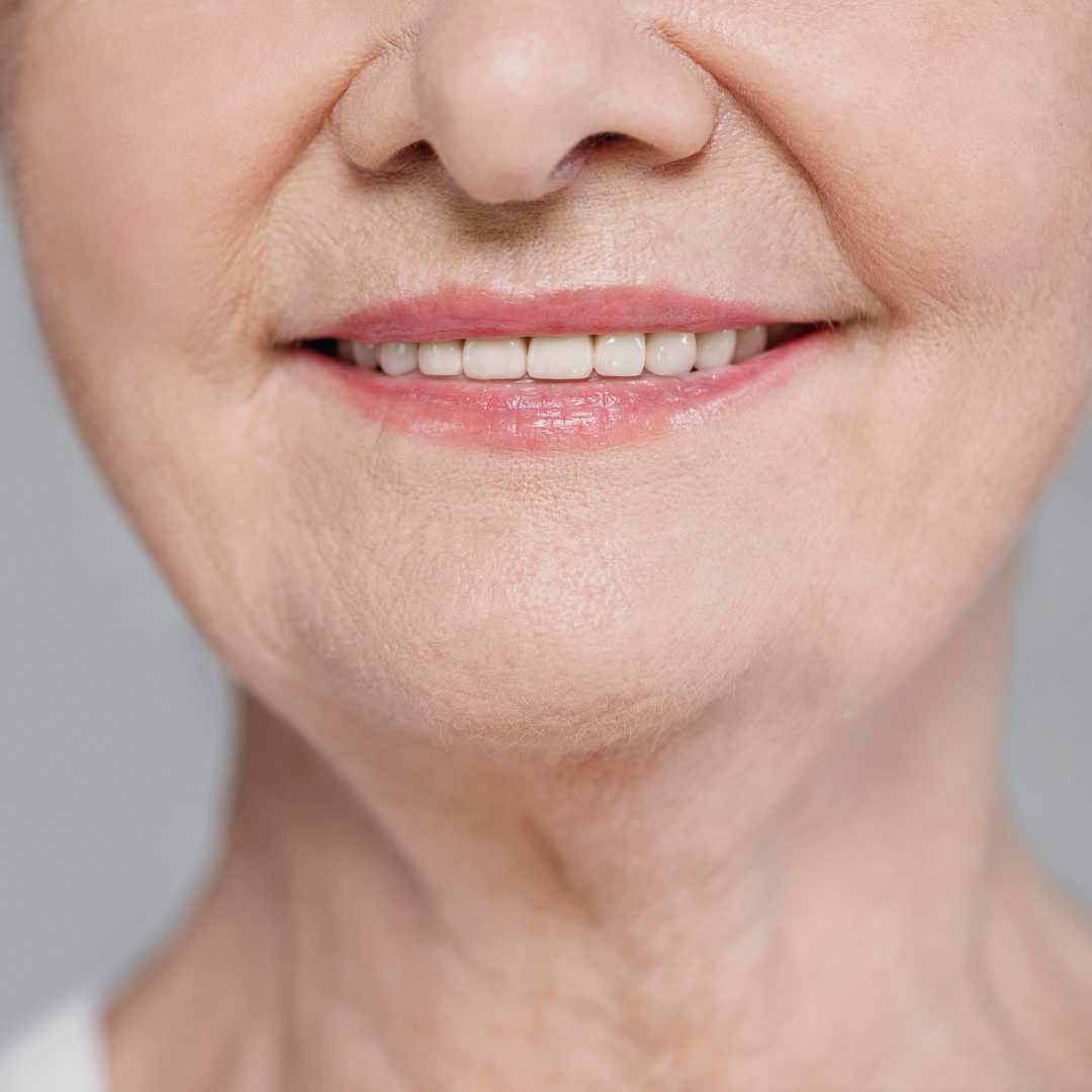 Paquete de restauración de boca completa en Los Algodones, México por ALL on X