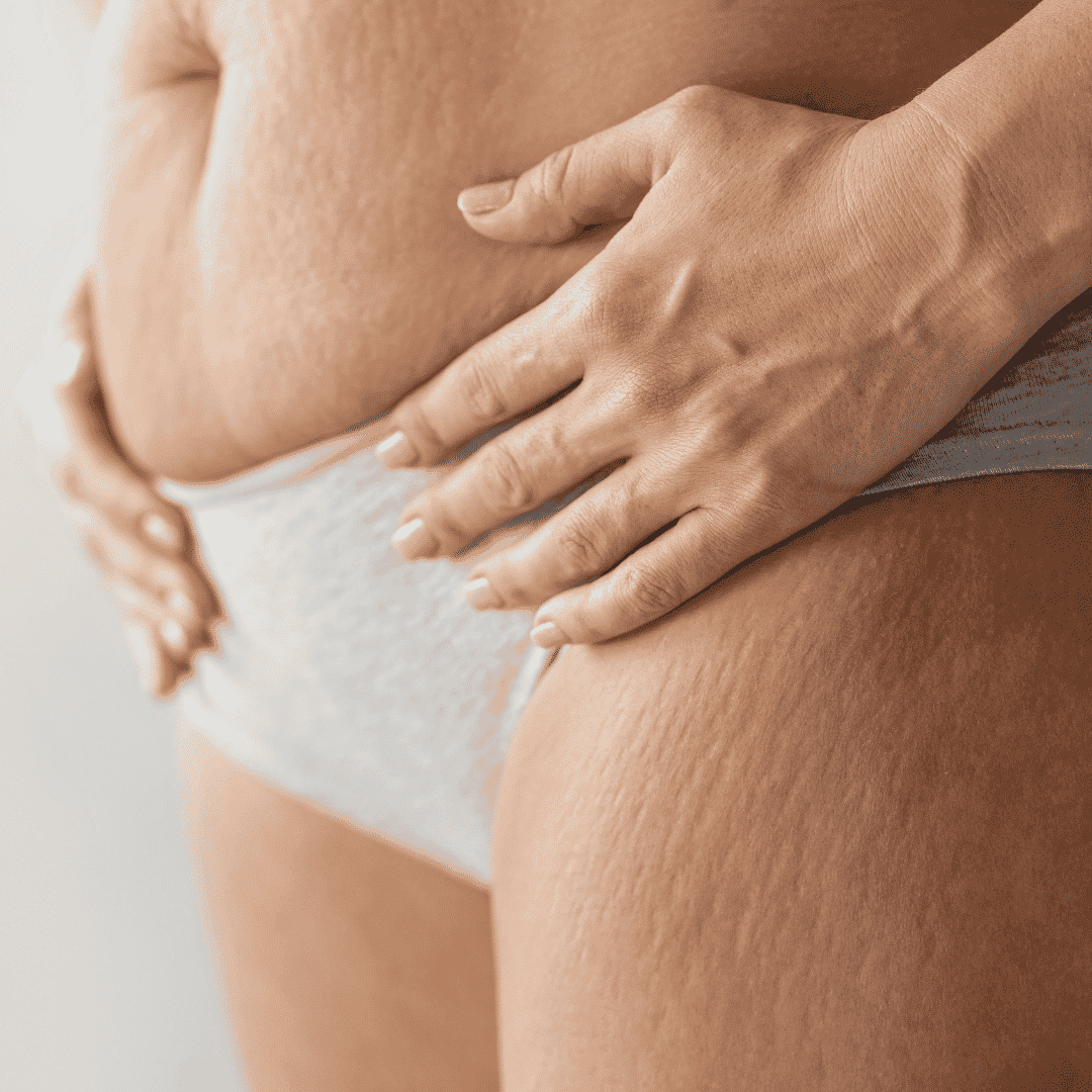 Paquete de Bypass Gástrico de Costamed en Cancún, México