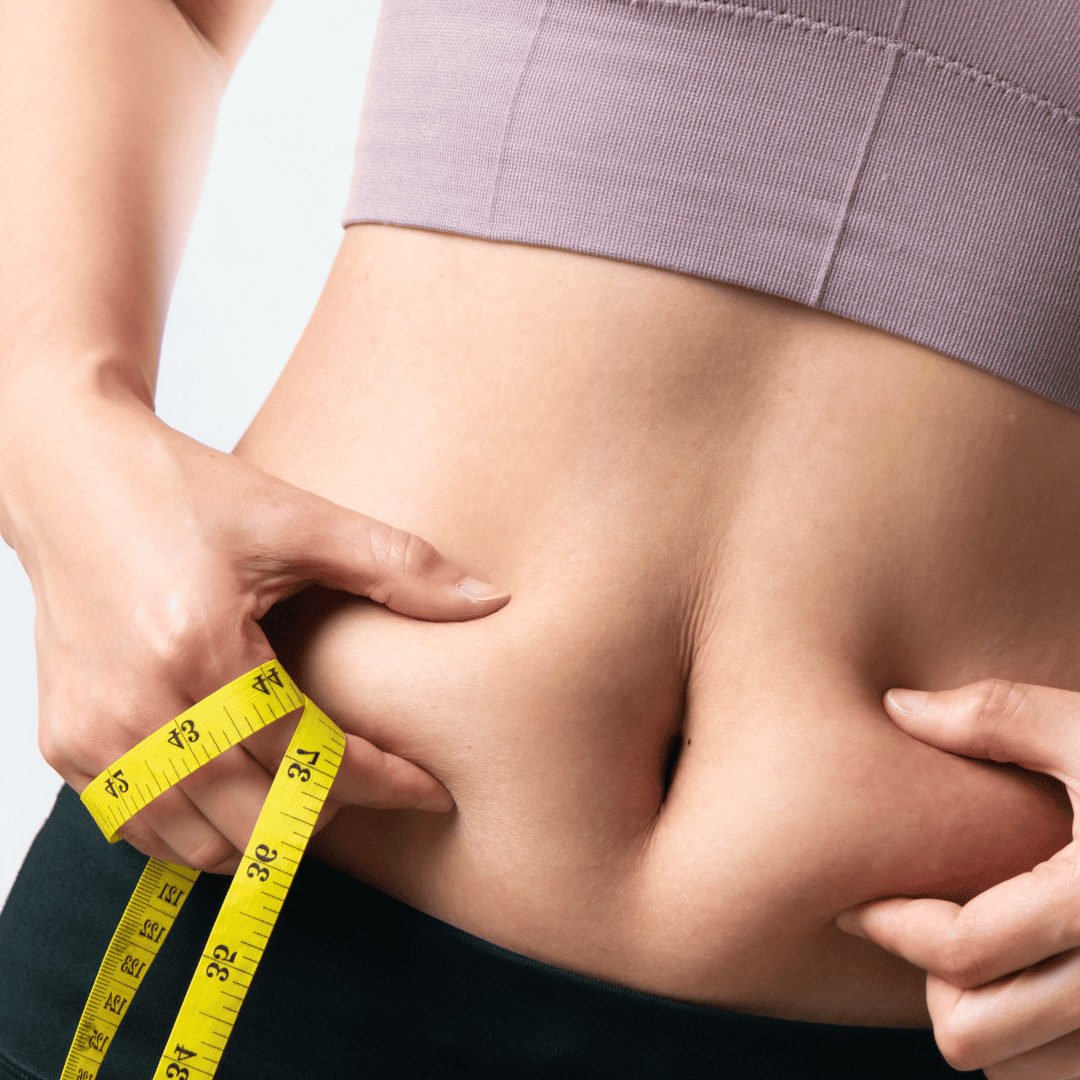 Procedimiento de Bypass Gástrico en Mexicali por el Dr. Elias Garcia