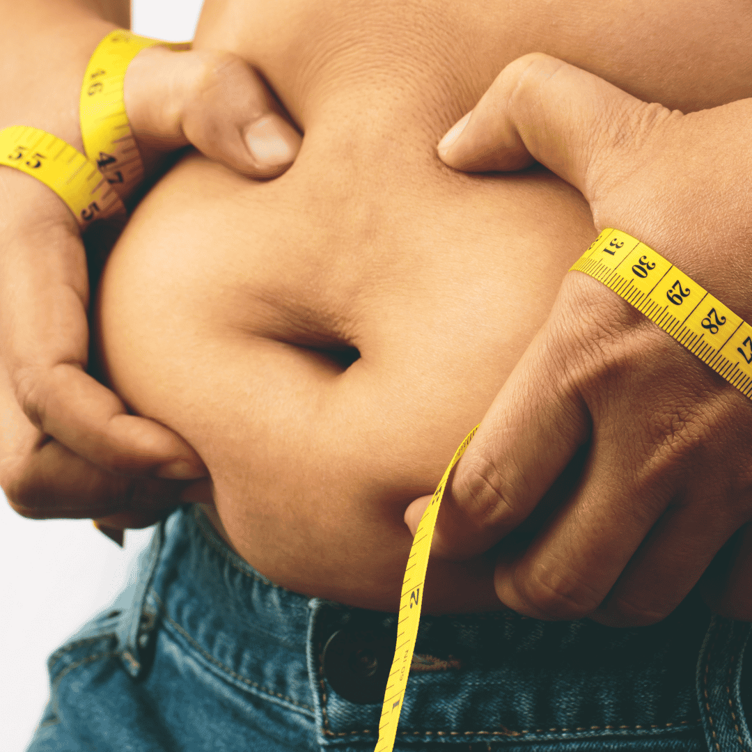 Gastric Bypass Surgery in Turkey