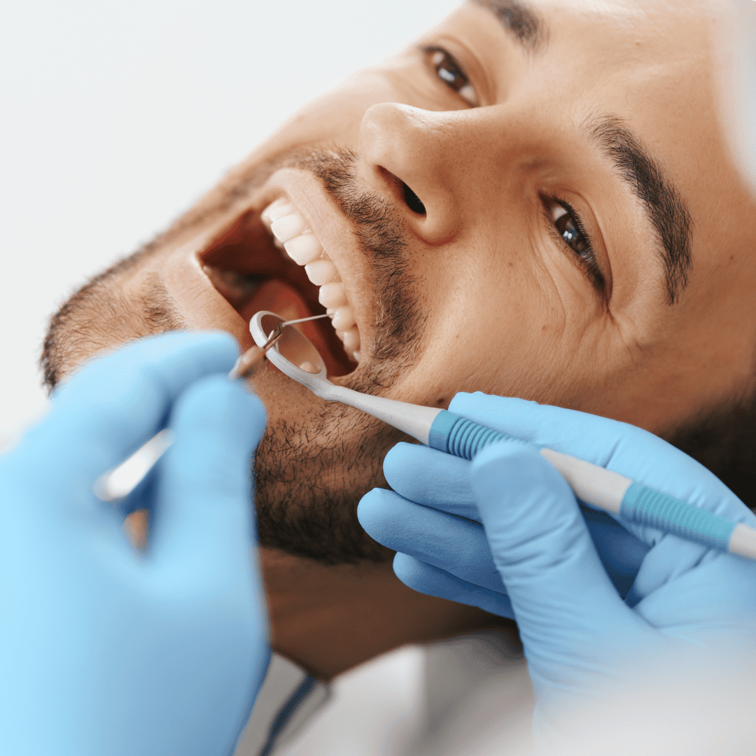Affordable Dental Implants in Tbilisi Georgia