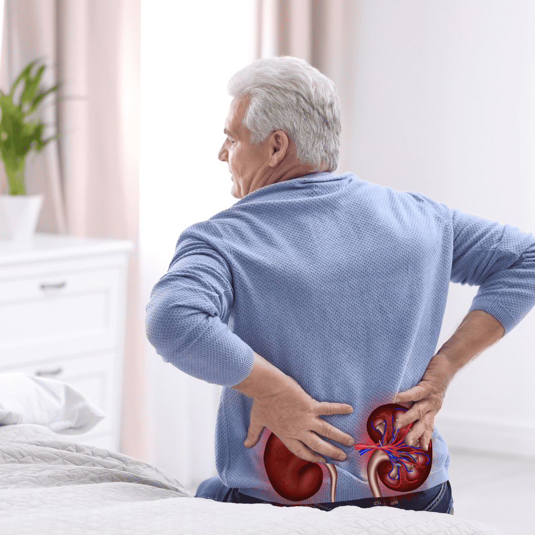 Stem Cell Therapy for Kidney Failure Package in Cancun, Mexico by Clinica MER