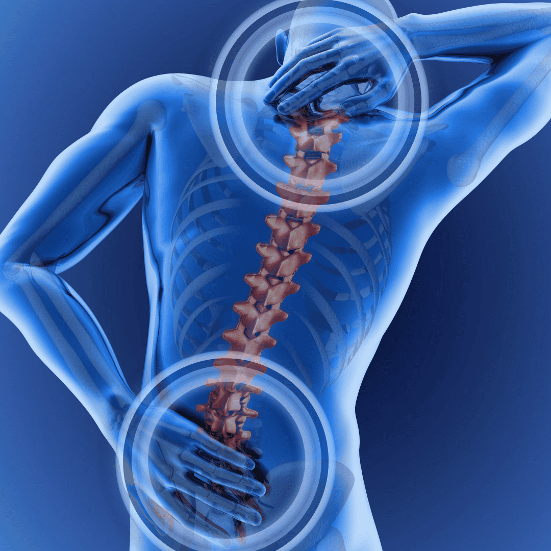 Stem Cell Therapy for Neck & Back in Colombia by Stem Cells Colombia