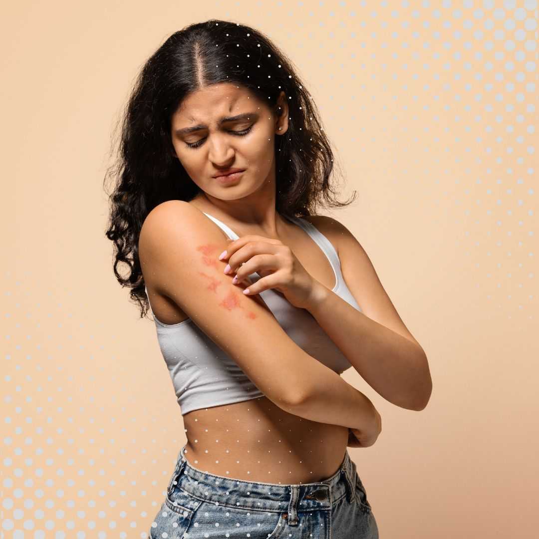 Premier Stem Cell Therapy for Psoriasis Package in Vienna, Austria by Stem Cells Austria