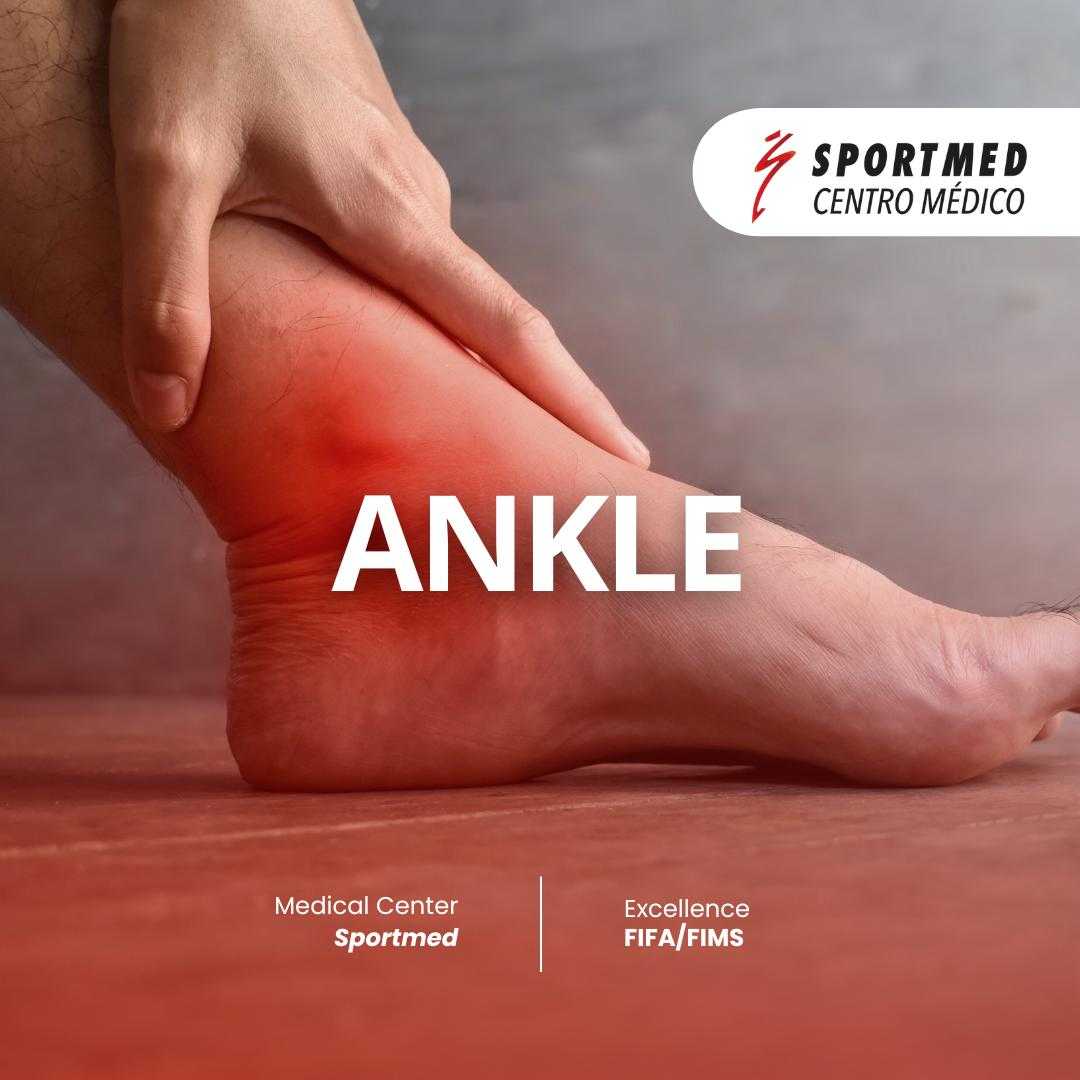 Stem Cell Treatment for Foot and Ankle Abroad Package at Sportmed Centro Medico, Guadalajara, Mexico