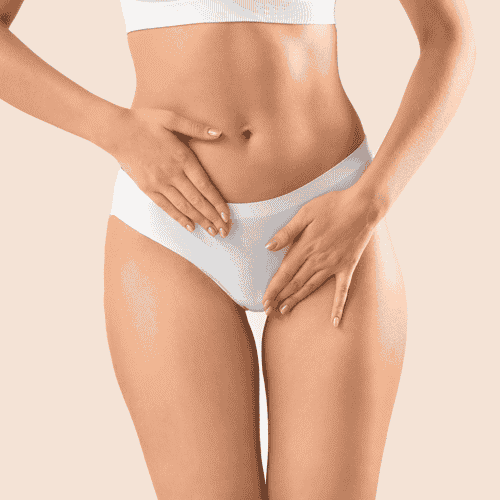 Liposuction Package in Guadalajara, Mexico by PARS