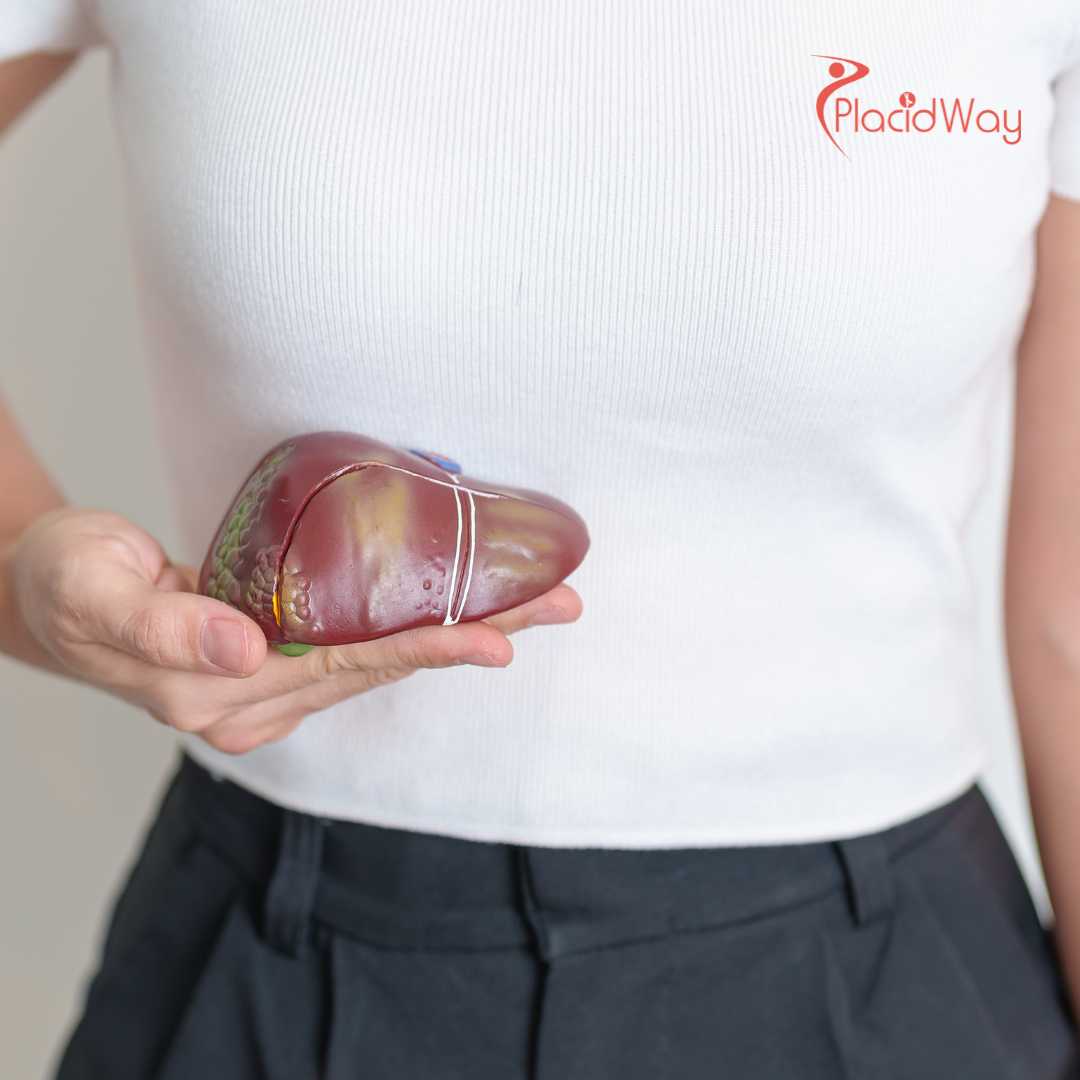 Paquete de Terapia con Células Madre para Cirrosis Hepática en la Clínica MexStemCells, Ciudad de México, México