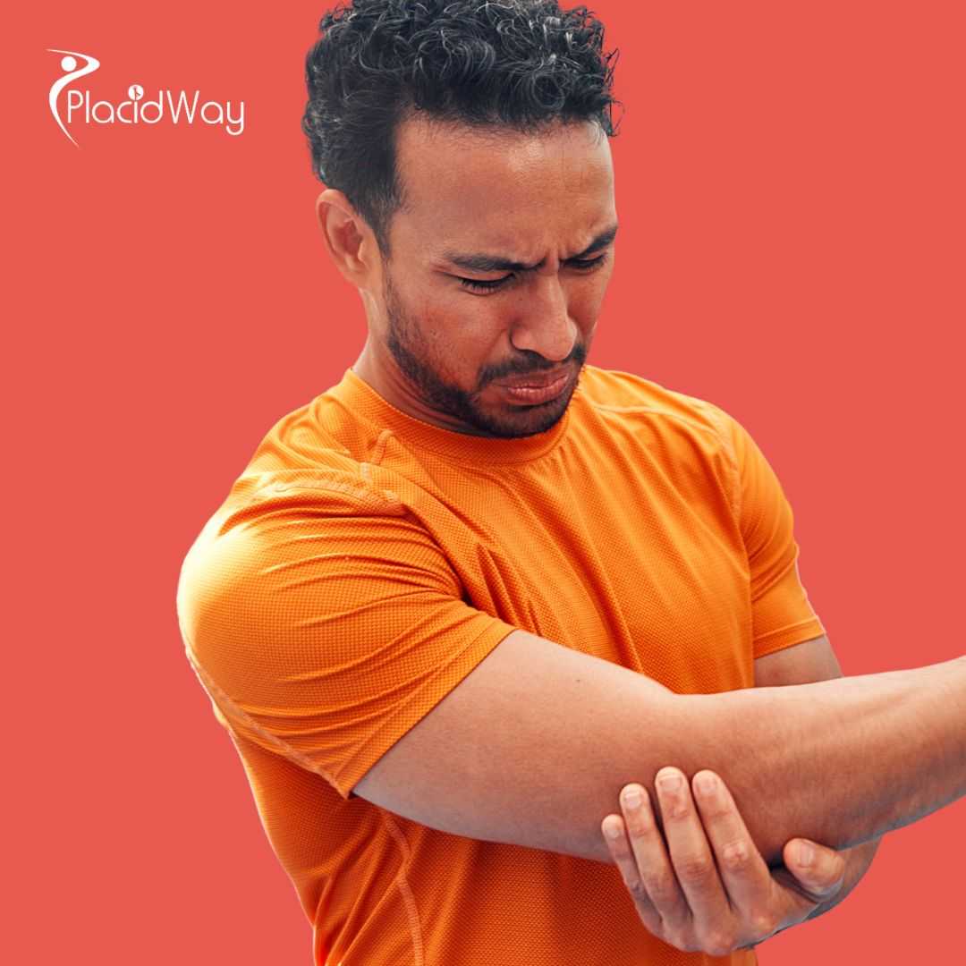 Stem Cell Therapy for Elbow Pain Relief Package in Mexico City, Mexico by MexStemCells