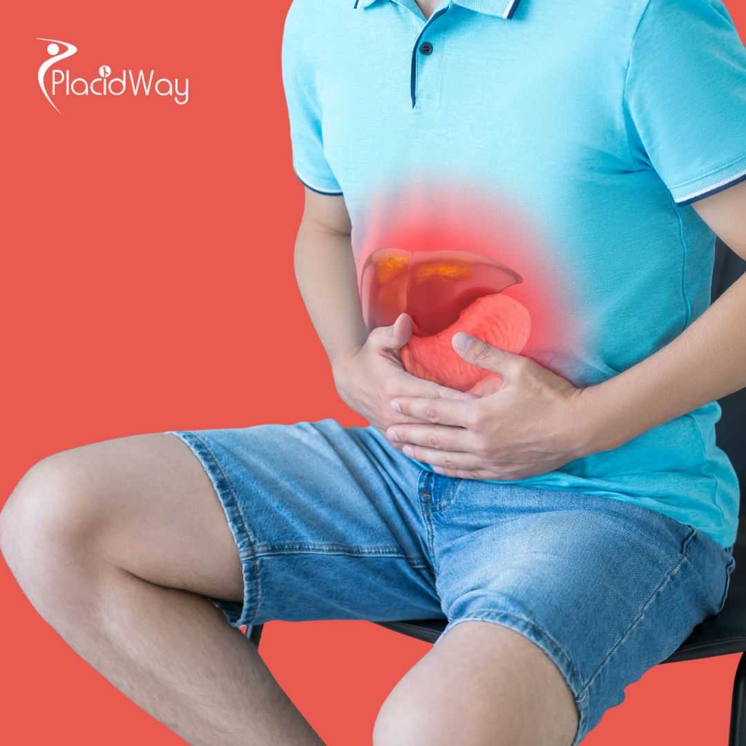Hiatal Hernia Repair Surgery in Tijuana, Mexico