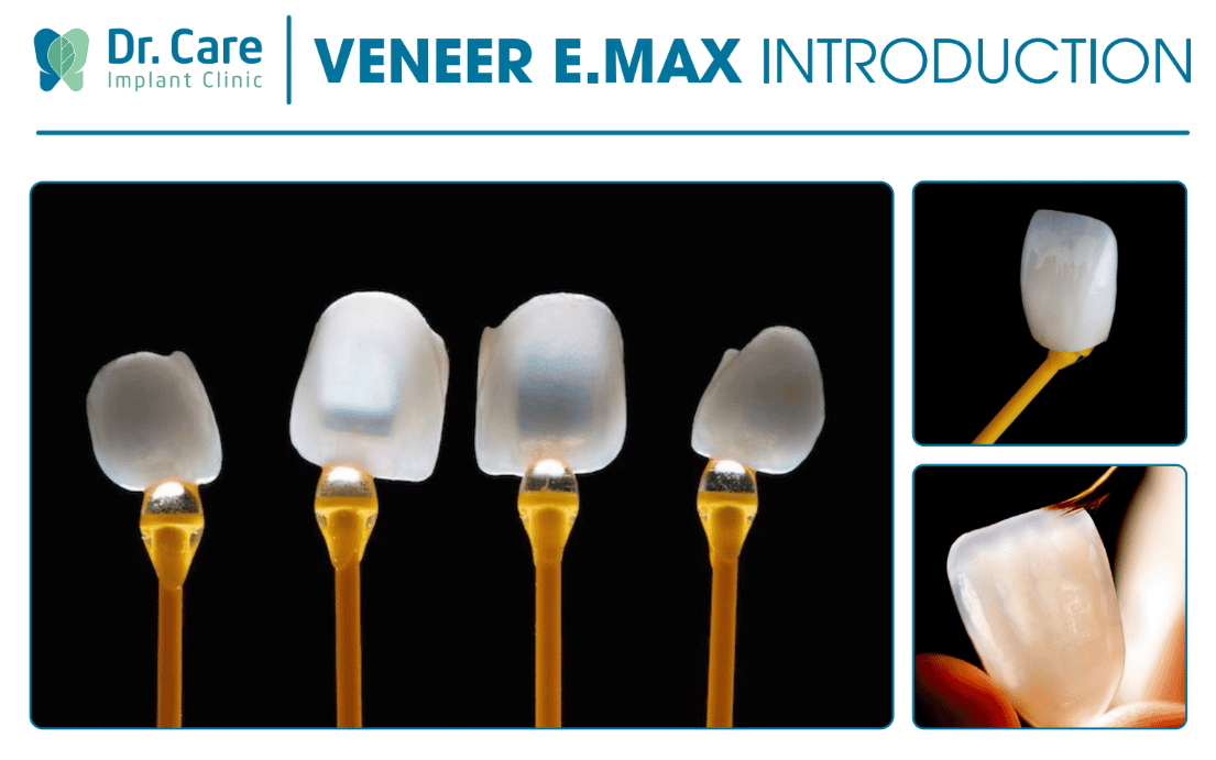 Dental Veneers Package at Dr. Care Implant Clinic, Hochiminh, Vietnam