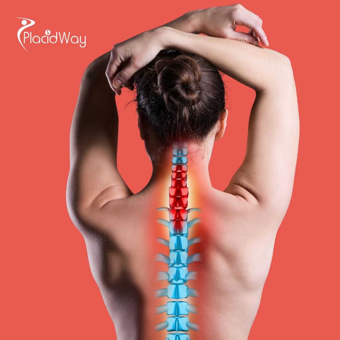 Stem Cell Treatment for Spinal Cord Injury Package in Cali, Colombia by Stem Cells Kyron