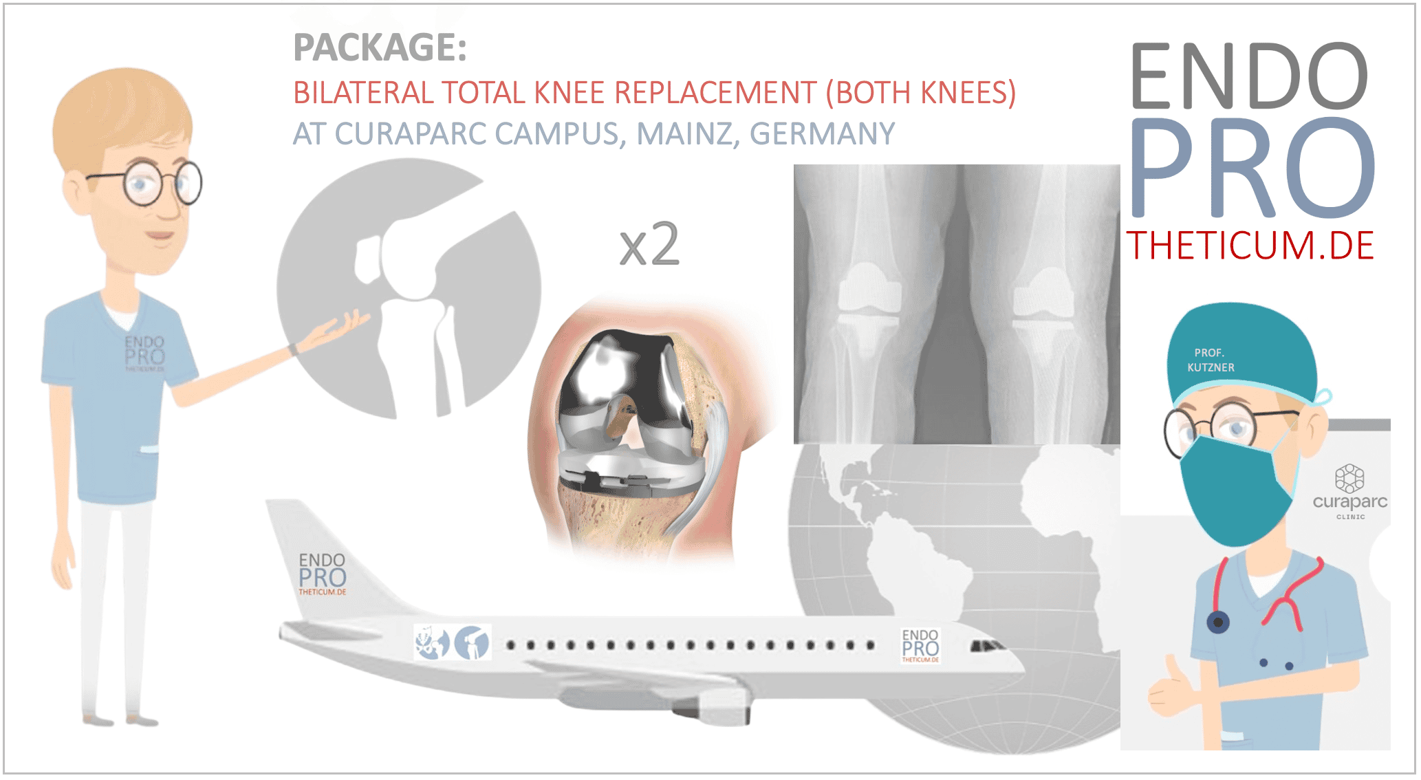 Bilateral Total Knee Replacement in Mainz, Germany (20 minutes from Frankfurt Airport)