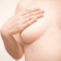 Breast Augmentation in Seoul, Korea by JK Plastic Clinic