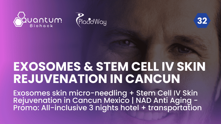 Exosomes skin micro-needling + Stem Cell IV  Skin Rejuvenation in Cancun Mexico | NAD Anti Aging - Promo: All-inclusive 3 nights hotel + transportation 