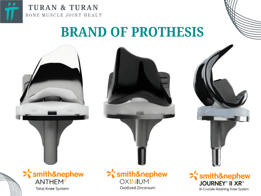 Robotic Knee Replacement Surgery in Istanbul, Turkey by Turan Turan